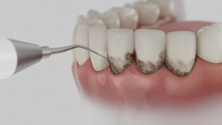 Reliable Tooth Extraction contractor in Glasscock County County, TX by Dentist Open Now